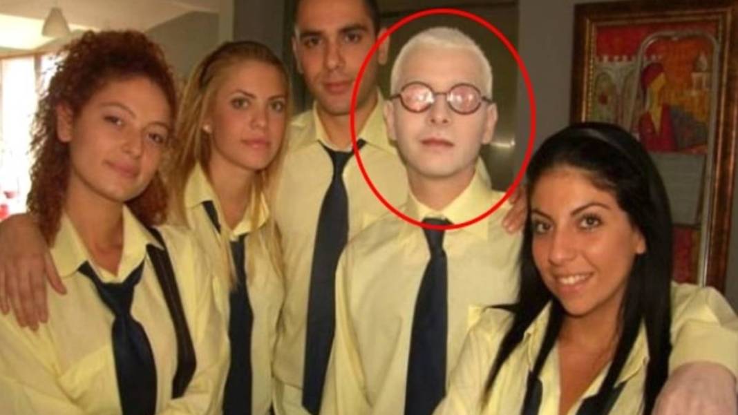 Pis Yedili dizisinin PC'si idi! Herkes onu albino hastası sanıyordu: Gerçek çok farklı çıktı! 3